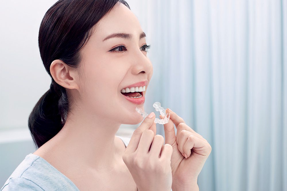 Invisalign Treament in Osaka for Adults