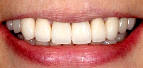 Esthetics and Orthodontics Example 2 After